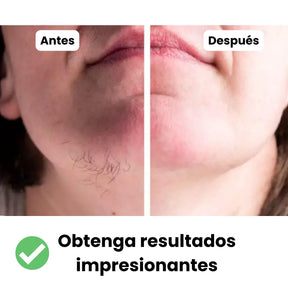 DEPILADORA FACIAL PORTÁTIL Y RECARGABLE